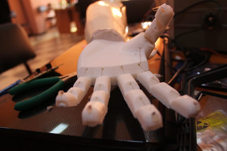 Prothesia Gana Competencia Online De Pioneer Con Solución Médica Impresa En 3d