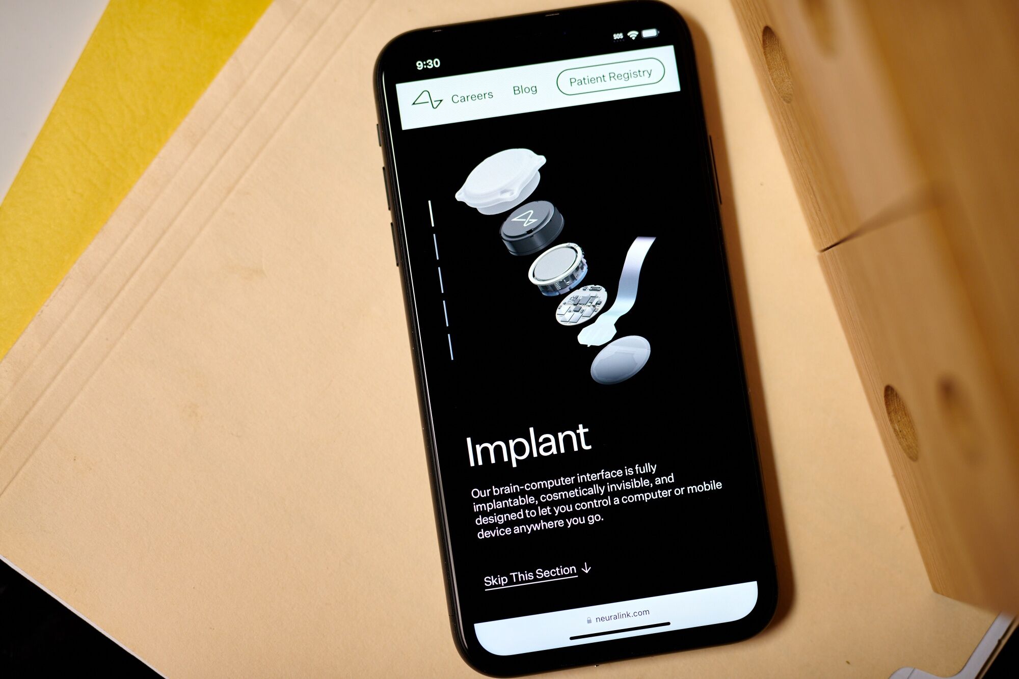 Neuralink Demonstra Paciente Tetraplégico Usando A Mente Para Controlar Computadores